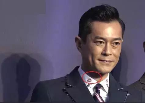 古天乐颈椎移位多少钱,古天乐颈椎移位需要多久