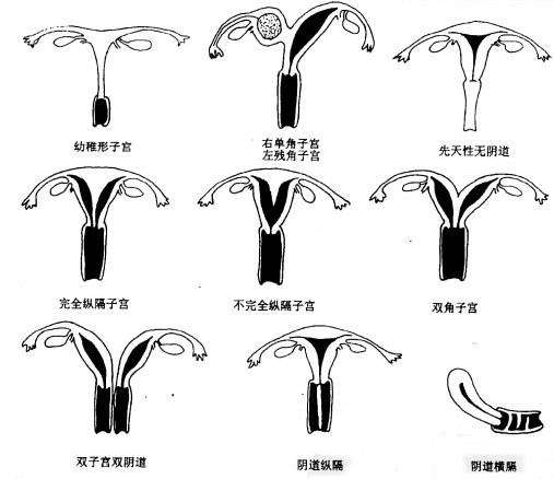 药物因素导致胎儿畸形视频,致胎儿畸形的药有哪些