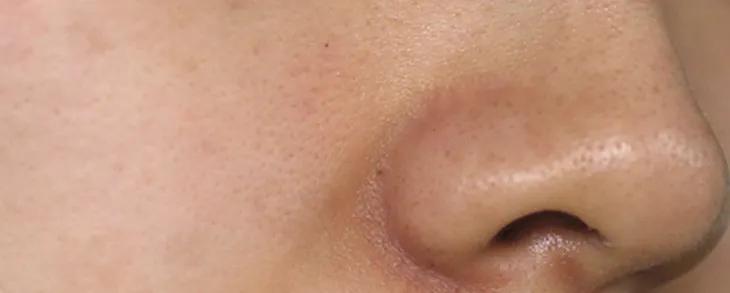 好皮肤怎么样养成的,好脸蛋