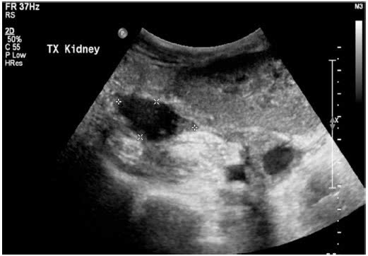男性乳房可以喂奶吗,男性乳房是不是也能哺乳