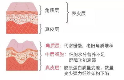 胶原蛋白流失怎么补救最有效,流失的胶原蛋白