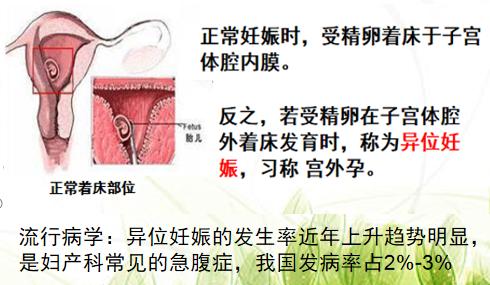 急诊宫外孕休克住院抢救流程,宫外孕被送医院抢救