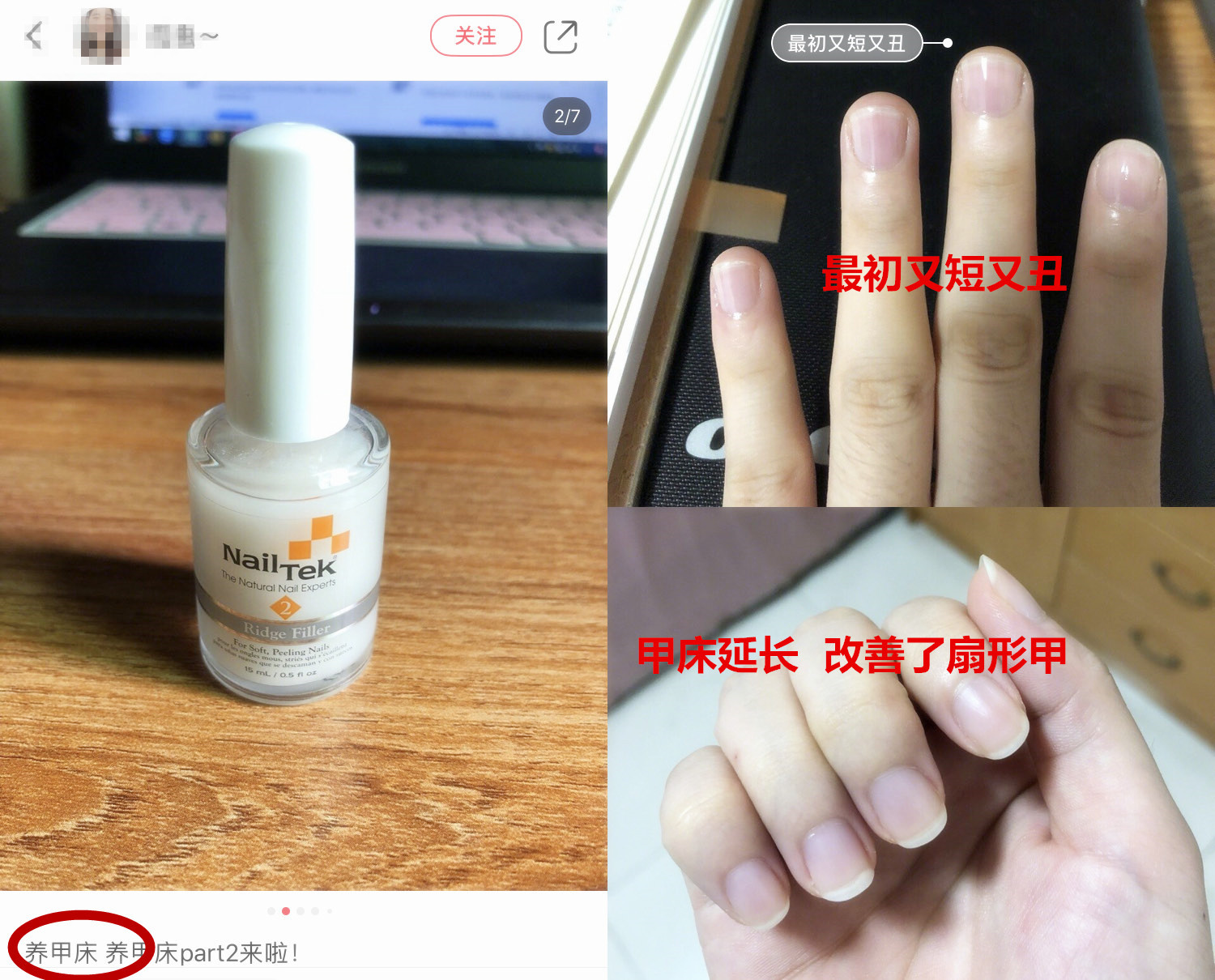 易劈易断还分层？美国专业沙龙修复甲油，给“病甲”快速“整容”