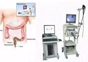 息肉癌变中晚期怎么治疗,如何确定胃肠息肉是否癌变
