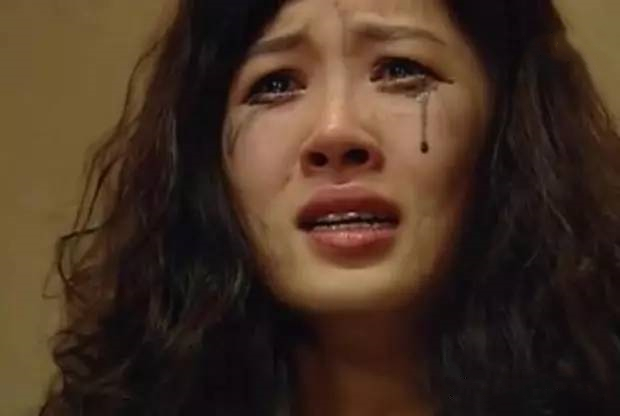 黑眼圈严重怎么办才能彻底去除,黑眼圈严重怎么办快速去除