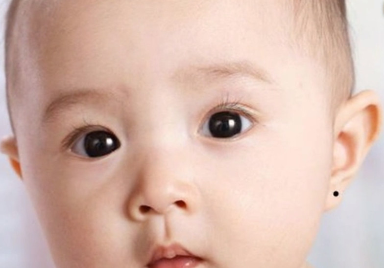 宝宝背后有痣代表什么,宝宝身上的痣会随着身体长吗