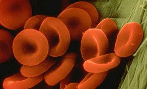 abo定型正反定型都是o是正常的吗,检验科标本不合格率