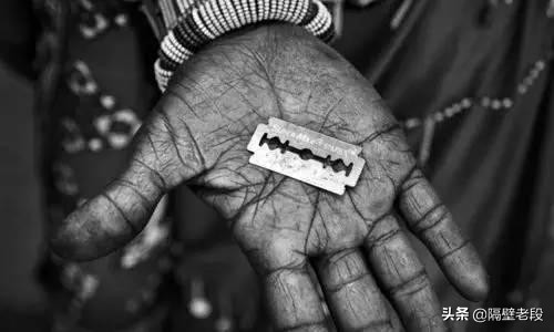 熨平少女胸部！揭秘非洲可怕习俗“烫乳”