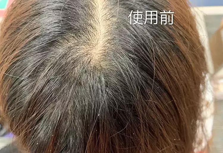 樱花头皮护理,樱花护发精油改善干枯防毛躁滋润