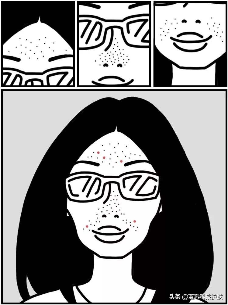 黑头太顽固教你去黑头的方法,去黑头的小窍门视频