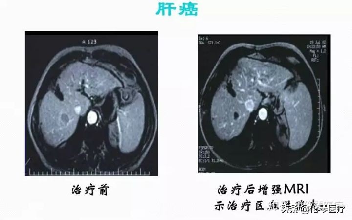 瑞金医院王忠敏,瑞金医院王忠敏简介