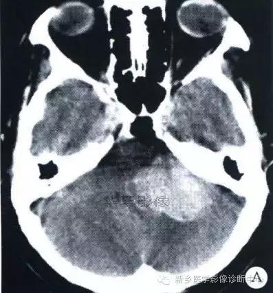 这些部位的黑色素瘤，您会诊断吗？