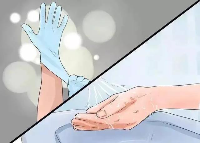 艾滋病皮肤溃烂一般从哪开始,艾滋病会皮肤溃烂表现吗