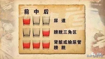 再也不懵，肾友自己完全可以看懂尿液检查了。