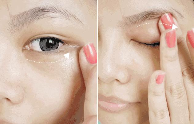 大眼袋眼纹抹平了,眼纹医美怎么去除