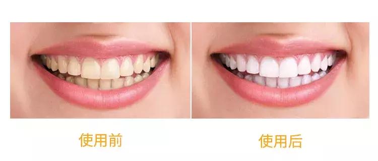 一口黄牙毁了一张脸视频,一口黄牙影响颜值