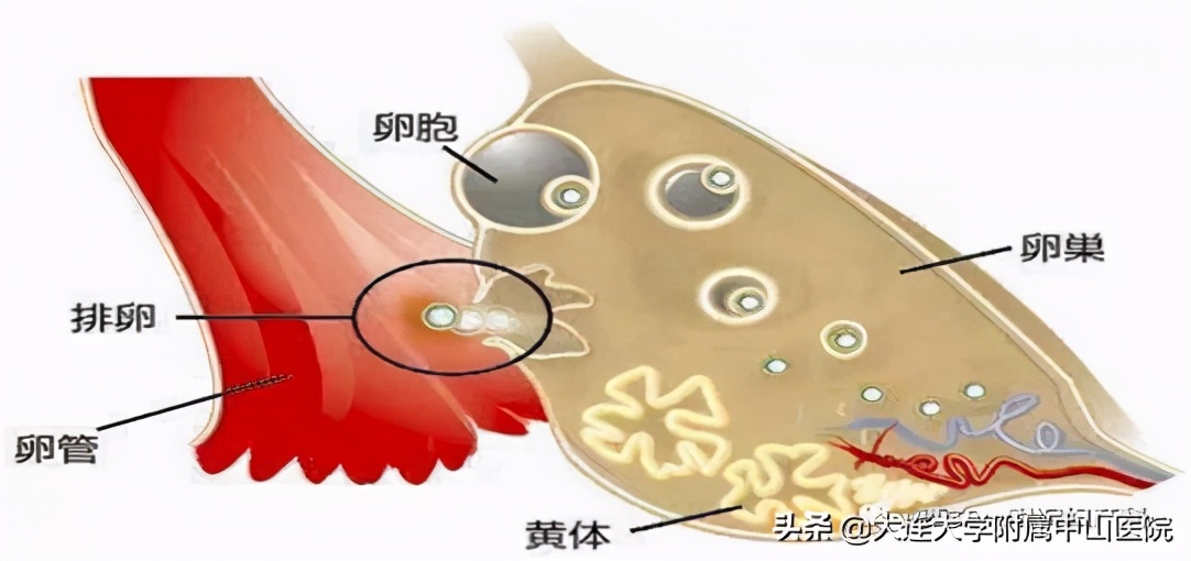 【女性频道】黄体破裂要注意！