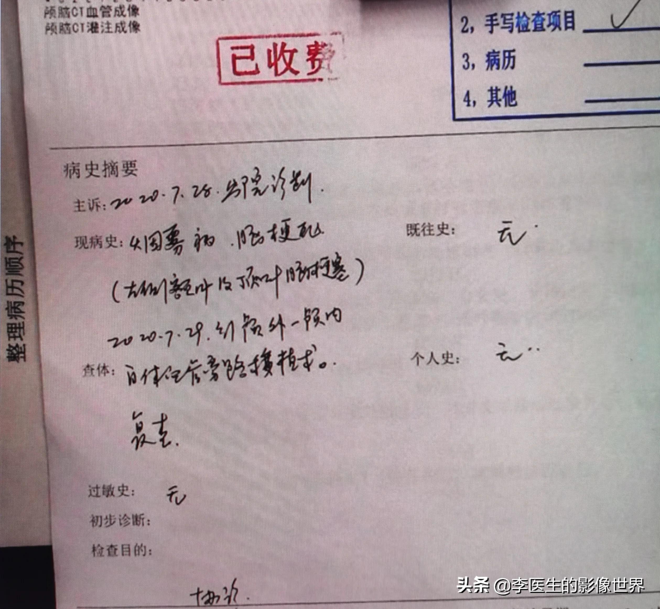 烟雾病灌注视频,烟雾病对脑梗溶栓的风险