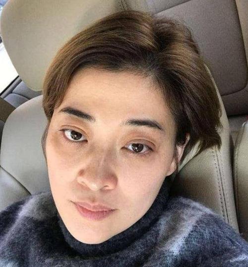 明星超皮秒祛斑,明星皮秒祛斑完整视频