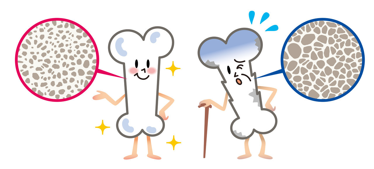 绝经早比绝经晚的人老得快吗,41岁绝经是不是老得快