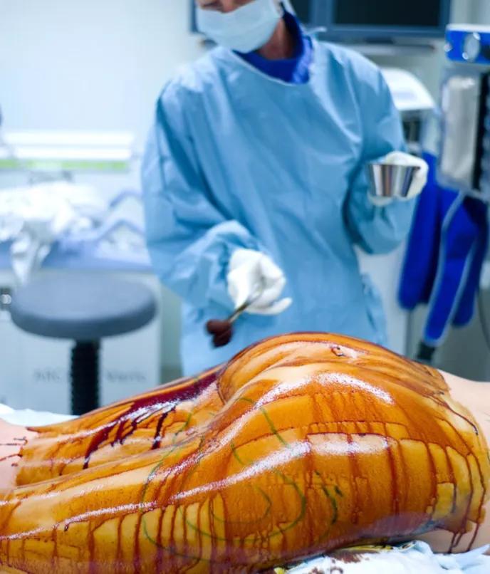 减肥反弹的真实案例,减肥反弹的真相千万要注意