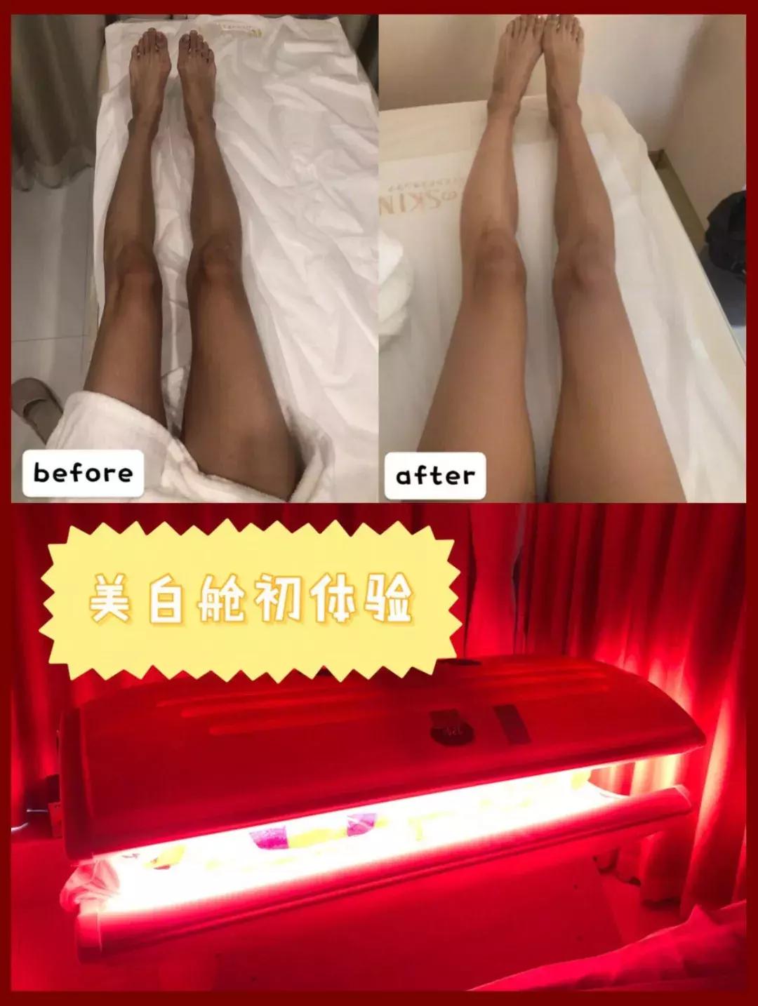 甜馨怎么这么白了,甜馨为啥那么黑