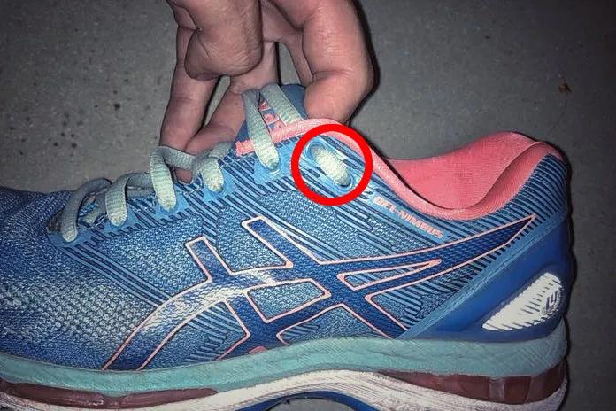 跑步跑出黑指甲怎么处理,跑步后脚趾甲充血变黑怎么办