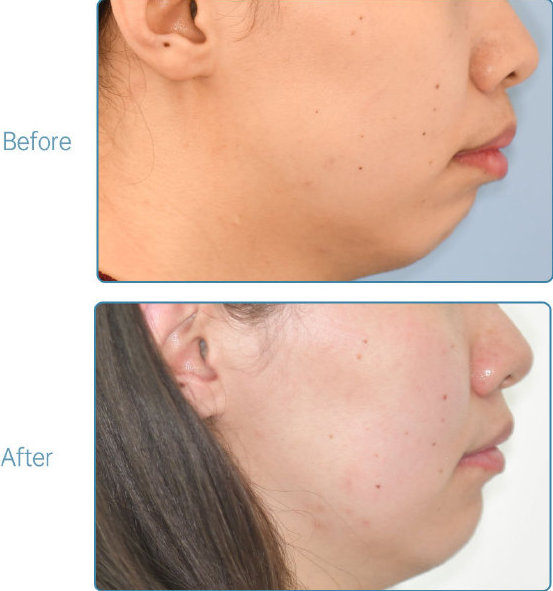 杭州口腔医院整牙,杭州整牙医生怎么选