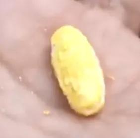 一夜硬三次，这谁受的了？治疗前列腺的药物为何导致阴茎异常勃起