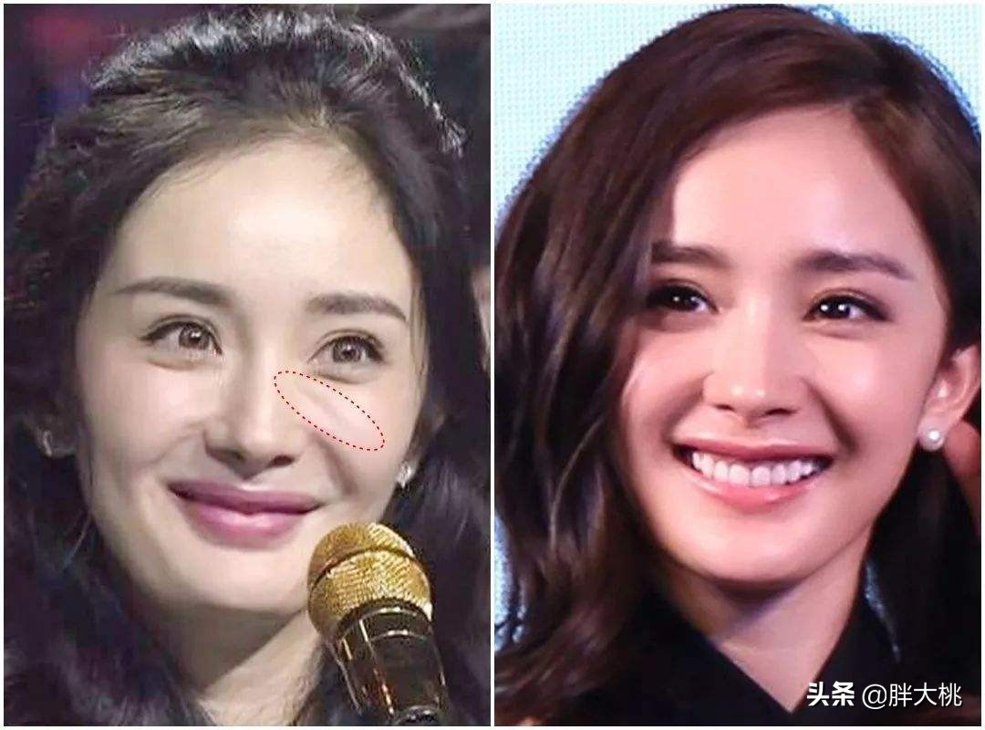 大幂幂、高圆圆、杨紫都逃不掉的法令纹，来找找适合你的方法