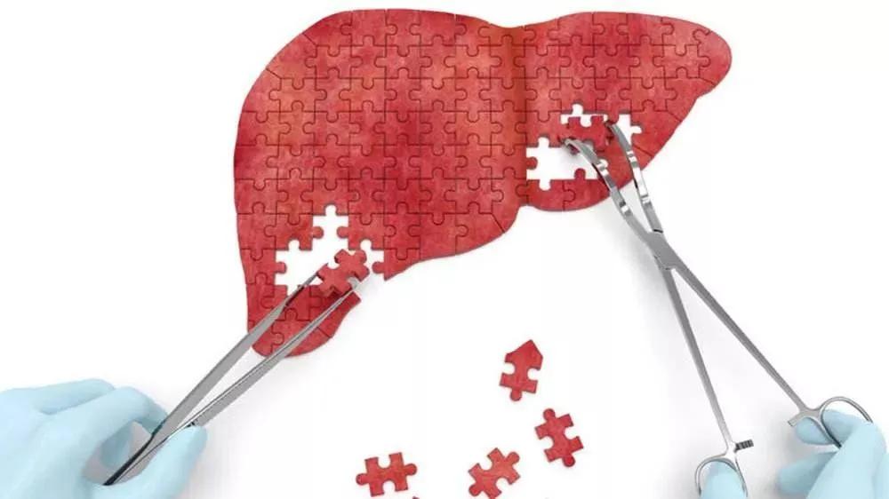 巨大肝囊肿怎么办,肝囊肿大了怎样做微创术