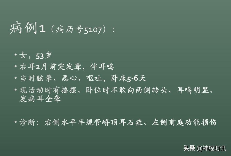 良性位置性眩晕诊断和治疗指南,良性阵发性位置性眩晕的诊断标准