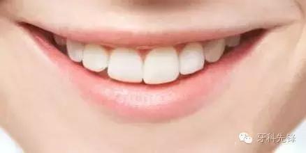 洗牙每年洗一次对牙齿好吗,多久洗一次牙为好洗牙多少钱