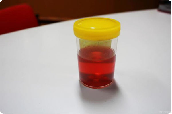 女性降肌酐需要吃什么药,女性肌酐低怎么调理