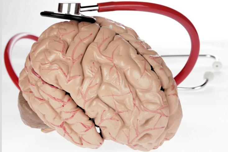 慢性硬膜下出血痴呆,慢性硬脑膜下血肿的病人症状体征