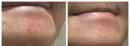 火山泥真是宝，油皮女孩的毛孔疏通剂，让贵妇霜3秒吃透锁水8倍