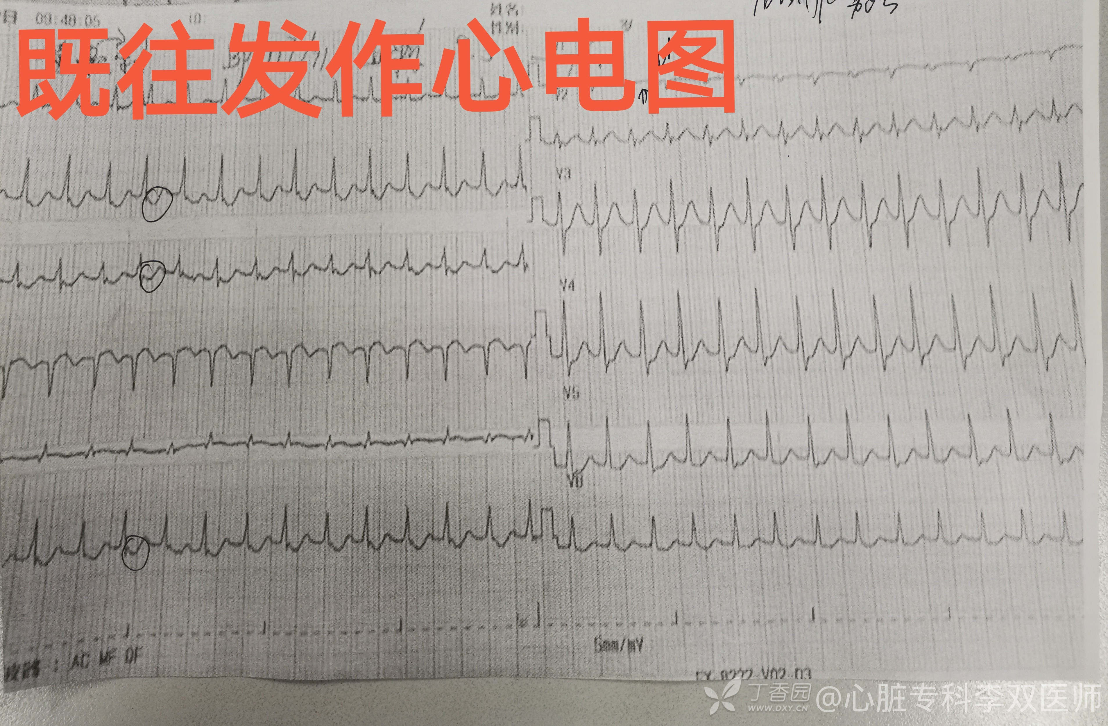 缁欒繙鍦ㄤ粬涔＄殑缃戝弸鎯呬功,缁欒繙鍦ㄤ粬涔＄殑缃戝弸瀵勪粈涔堢ぜ鐗╁ソ