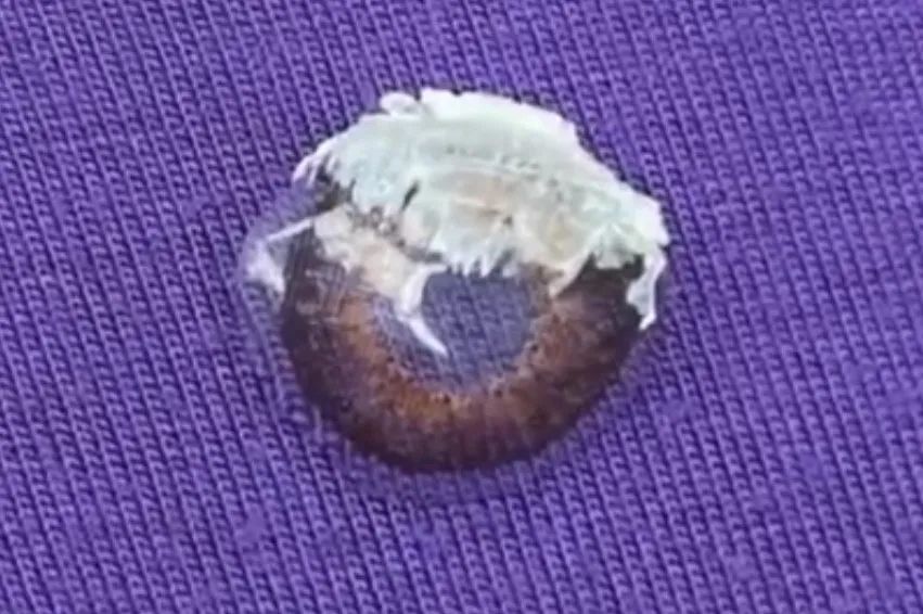 502误当眼药水,宝宝误把502胶水当成眼药水