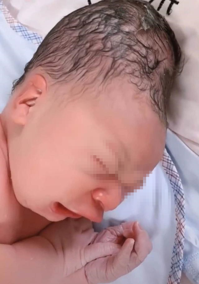 顺产宝宝的头为什么那么长,顺产小孩的头很长怎么办