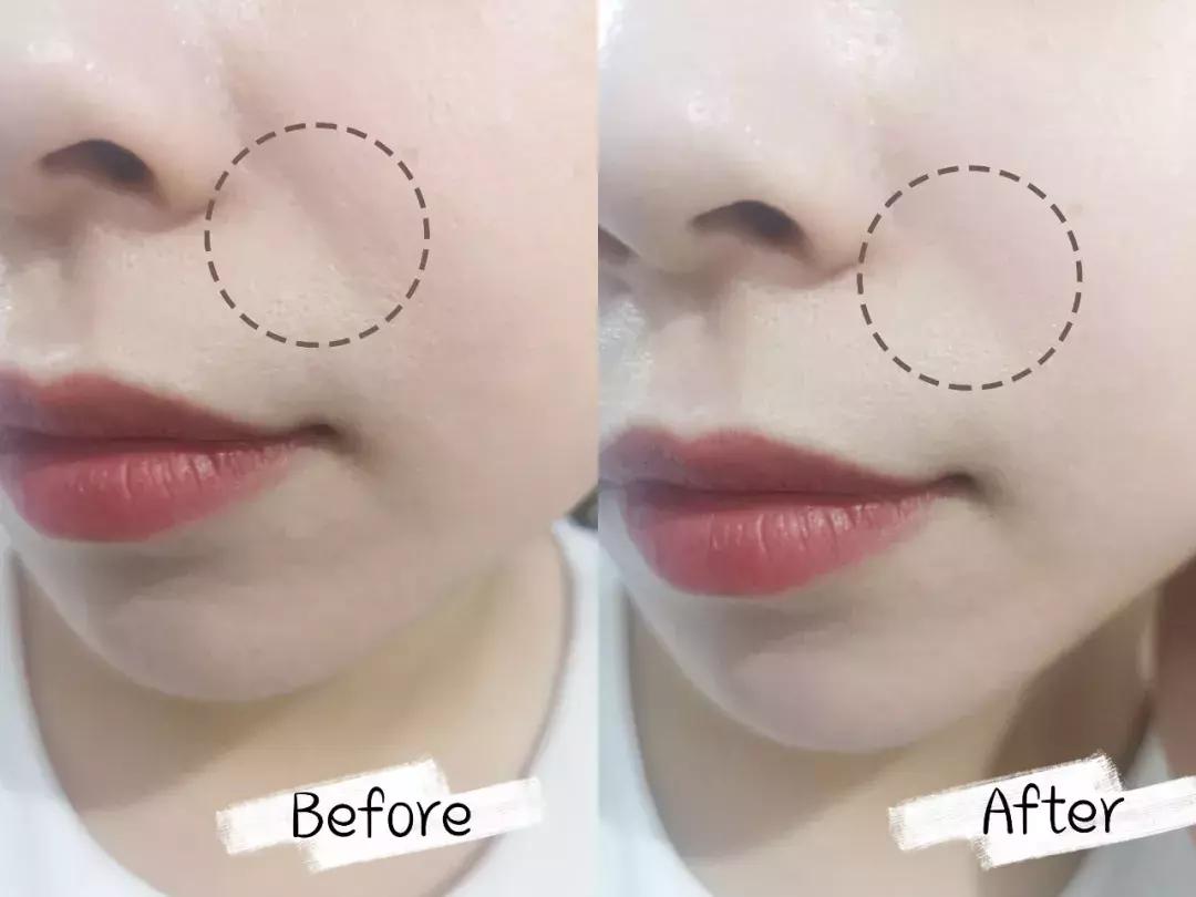 资生堂抗皱小雷达是哪个系列,资生堂的抗皱雷达好用吗