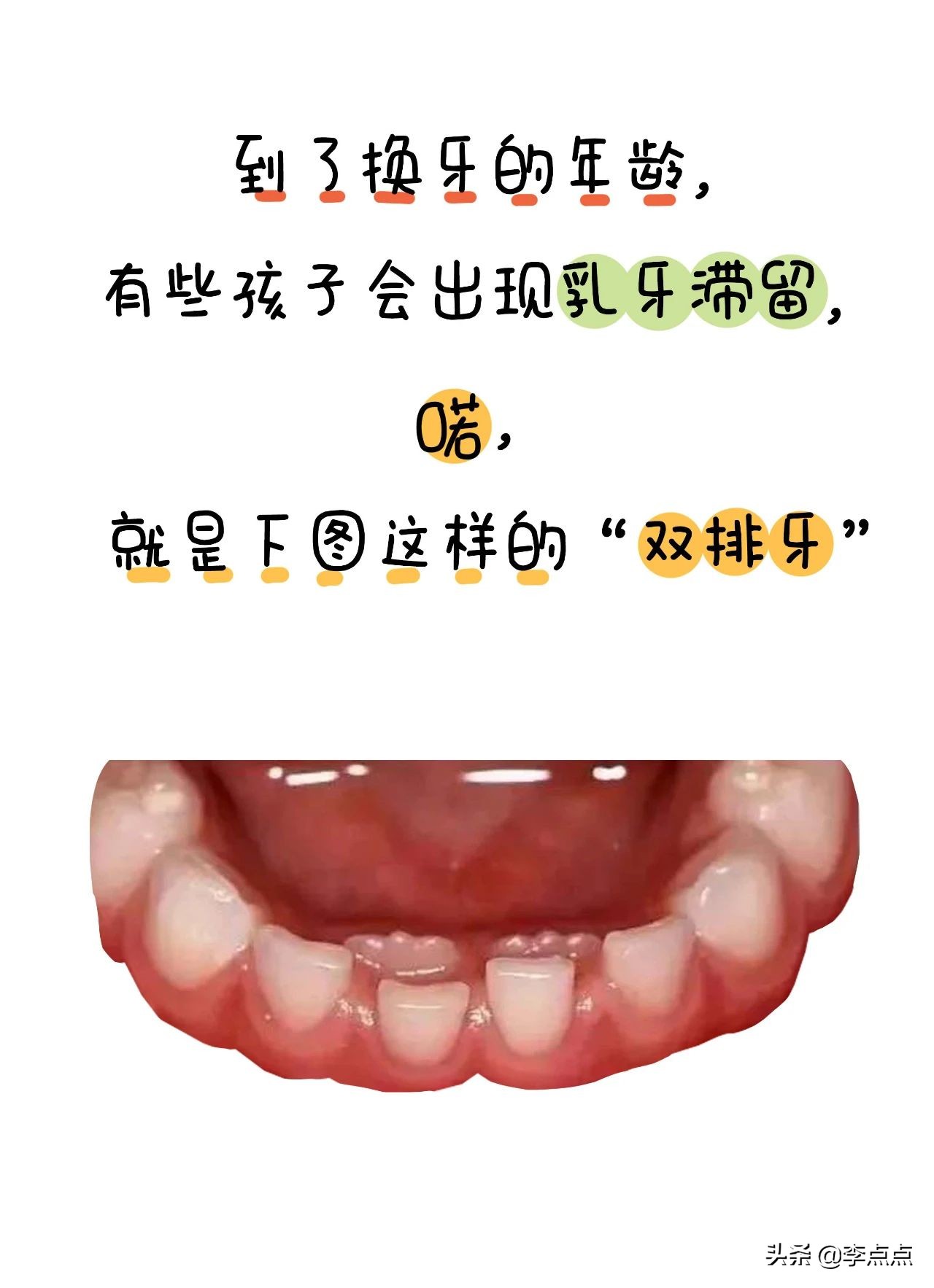 一到下午就口齿不清,口齿不清咀嚼无力