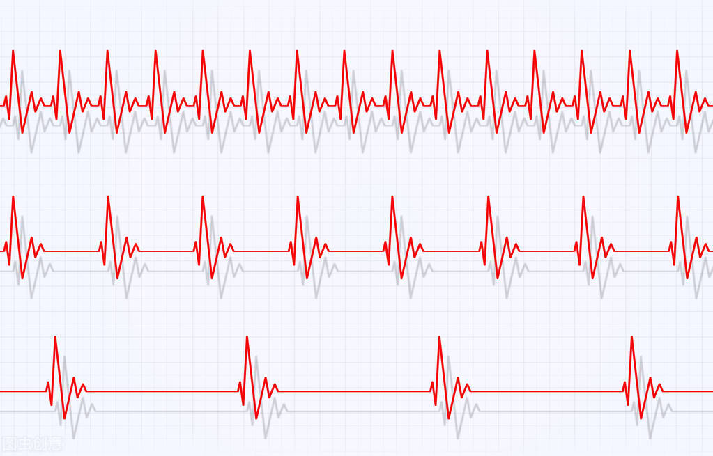 心动过速的食疗方法,怎样预防室上性心动过速