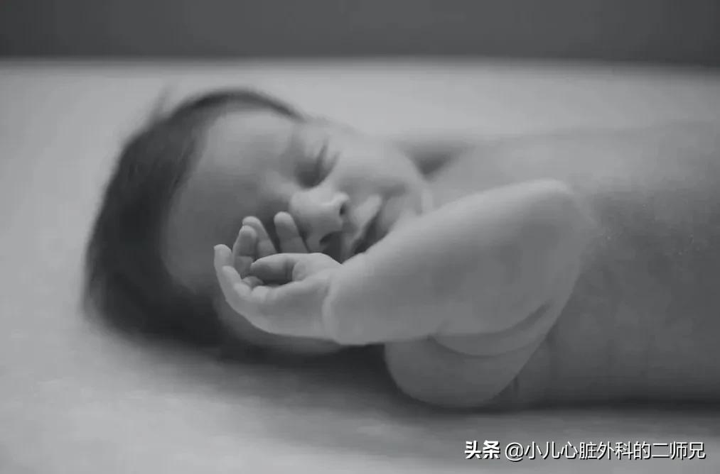 儿童先心病手术成功后能恢复吗,宝宝先天性心脏病需要做手术吗