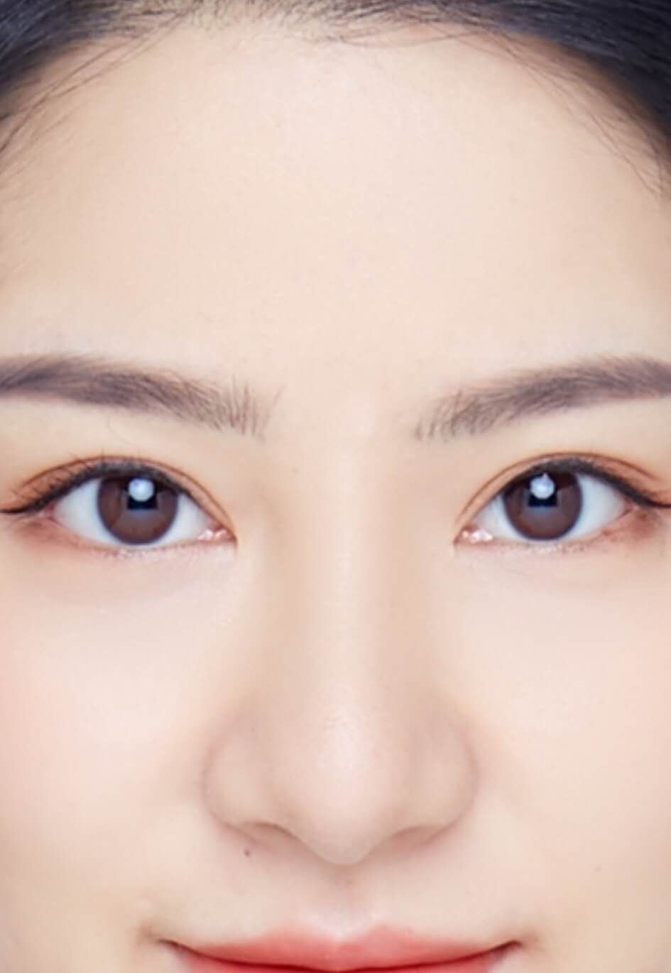 全切双眼皮术后会变内双吗？