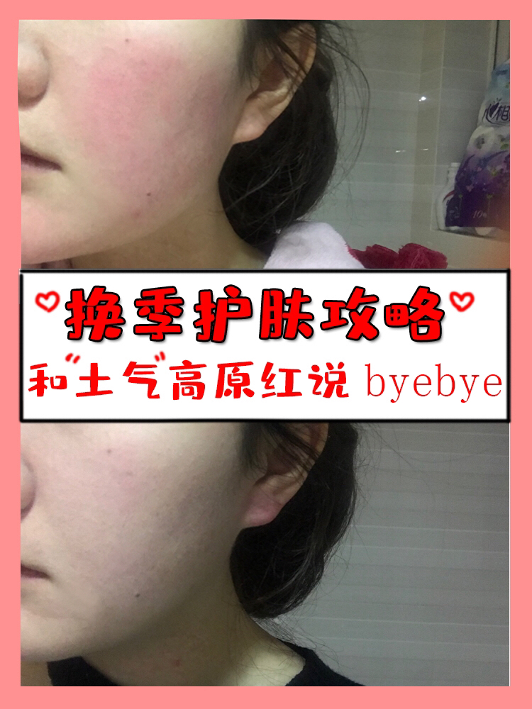 换季必囤简直是敏感肌救星,拯救夏秋敏感肌