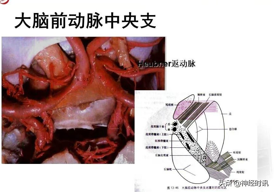 脑动脉解剖学讲解,基底节区脑血管解剖