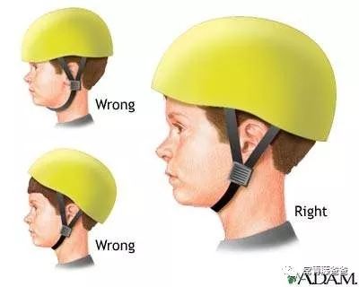 小朋友在美国险些脑袋开花，全靠麻省这条法律捡回一条命