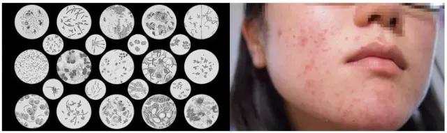 最强蜂胶,超级天然蜂胶