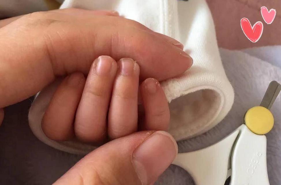 孩子手上老是有倒刺是缺乏什么,手指起皮长倒刺是缺乏什么维生素