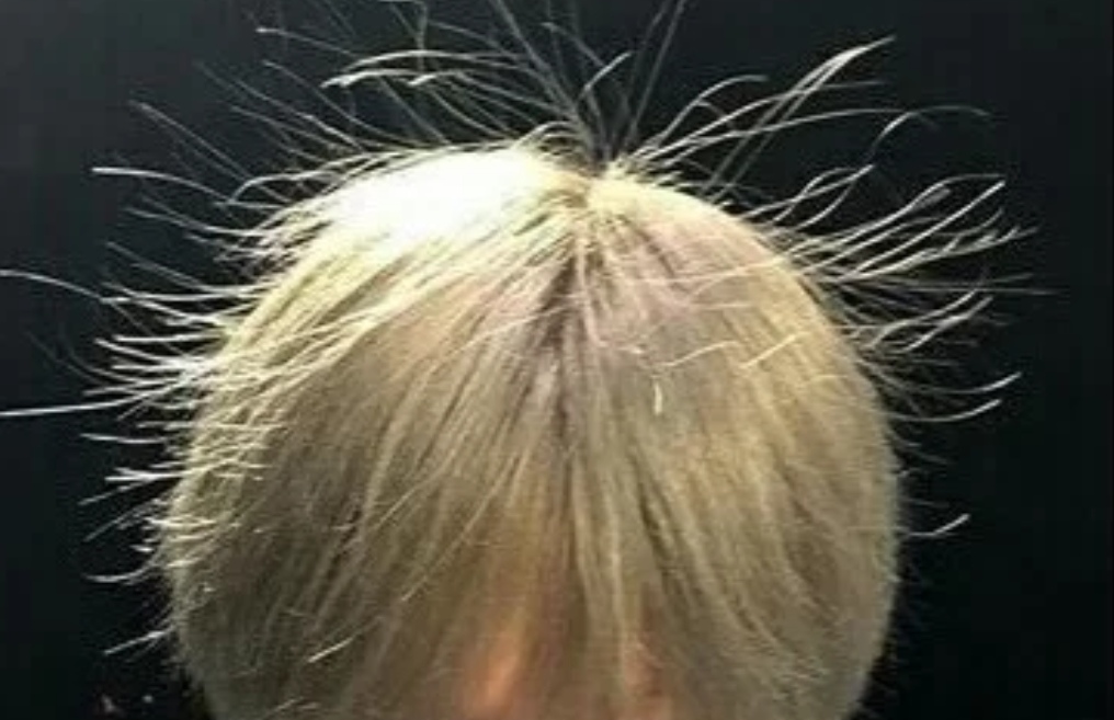 头发防静电的处理小妙招,冬天头发老是有静电怎样避免静电